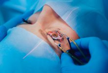 cirurgia-refrativa-a-laser-para-correcao-de-grau:-quem-pode-fazer,-beneficios-e-riscos